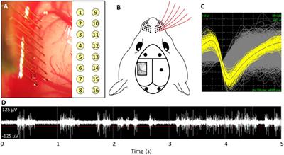 Correlation of mRNA Expression and Signal Variability in Chronic Intracortical Electrodes